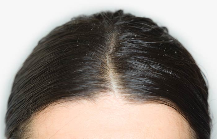 How to care outlet hair after smoothening